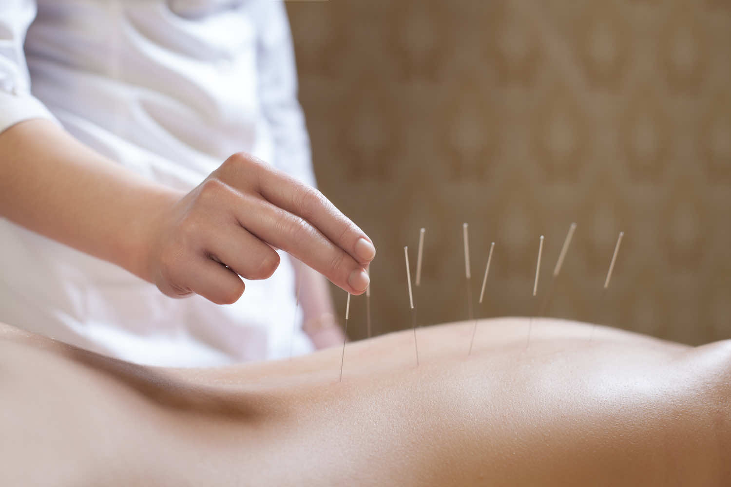 Acupuncture for skin conditions in Toronto