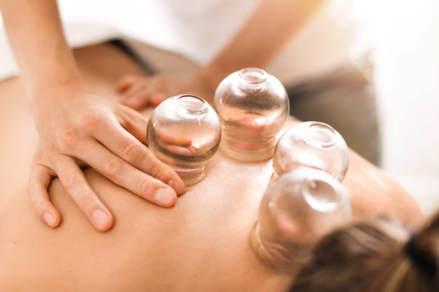 Cupping for addiction treatment in Toronto