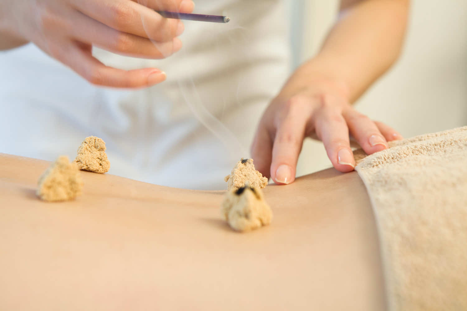 Moxibustion for health issues in Toronto