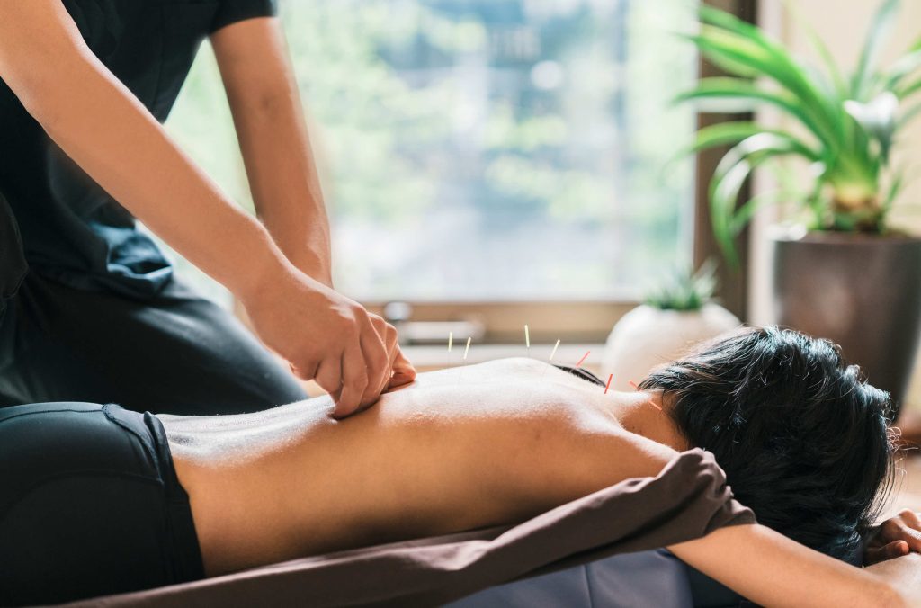 Acupuncture to treat anxiety in Toronto